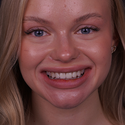 После лечения