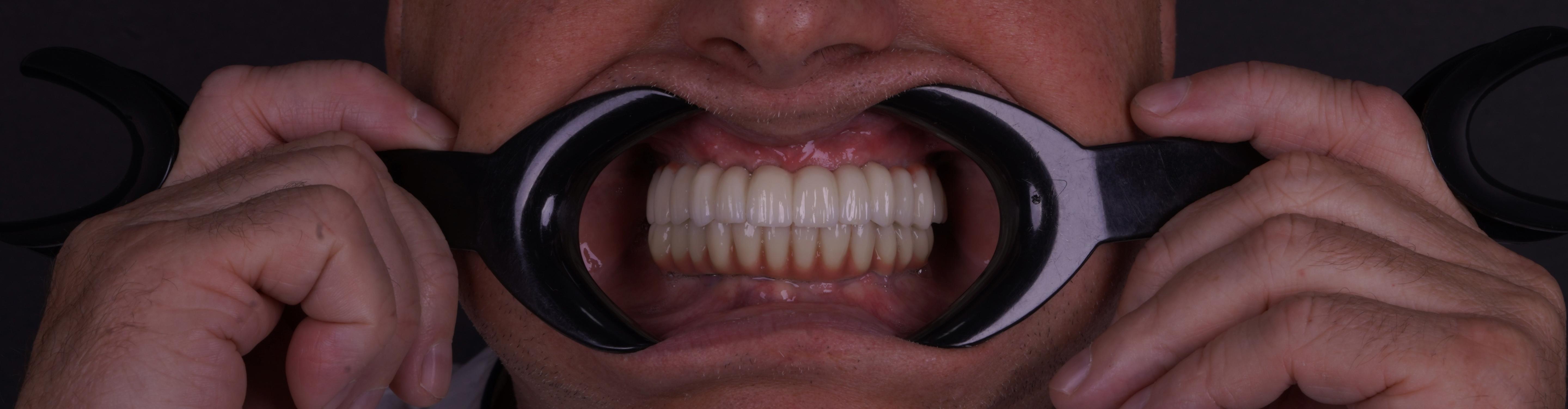 После лечения