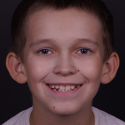 После лечения