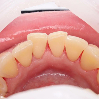 После лечения