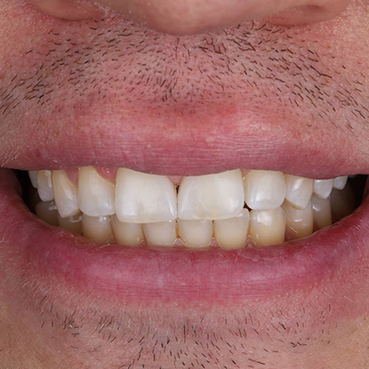 После лечения