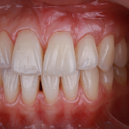 После лечения