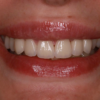 После лечения