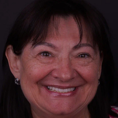 После лечения